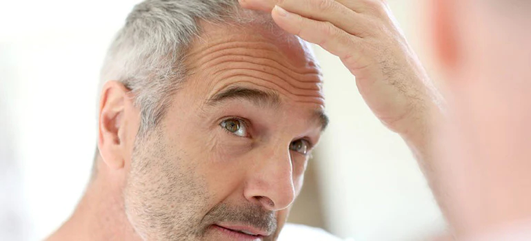 older man worrying about his thinning hair