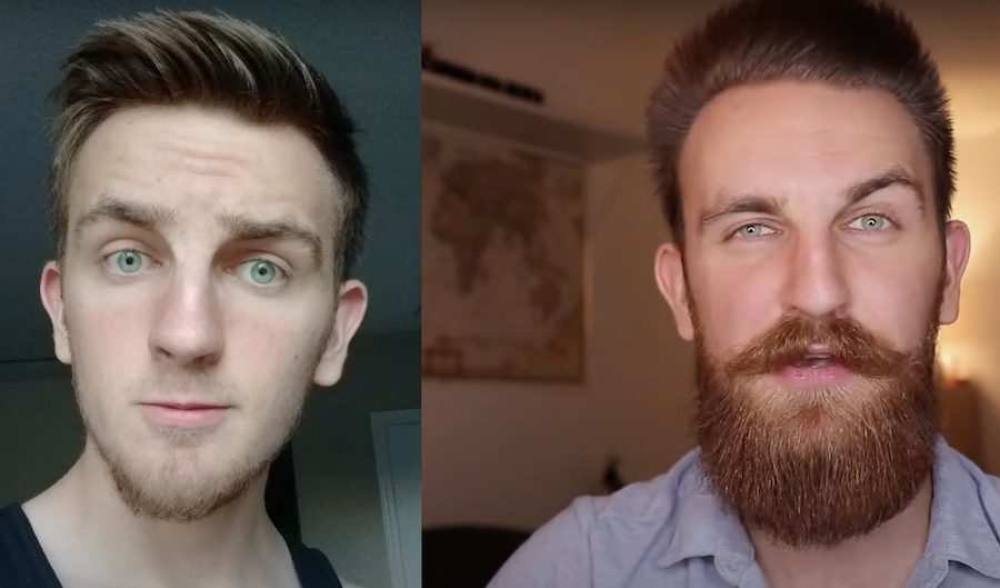 Youtuber Kaz Veselka and the results of using Minoxidil to improve hair growth in his beard and moustache