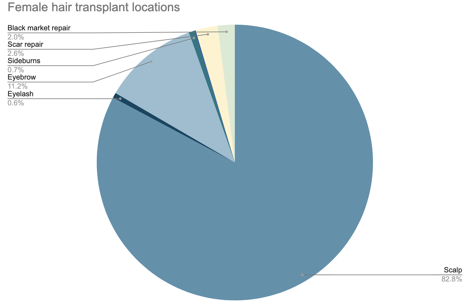 pie chart showing percentage of female hair transplant locations - 82.8% have scalp transplants, 11.2% have eyebrow transplants, 2.6% have scar repair, 2% have black market hair transplant repair.