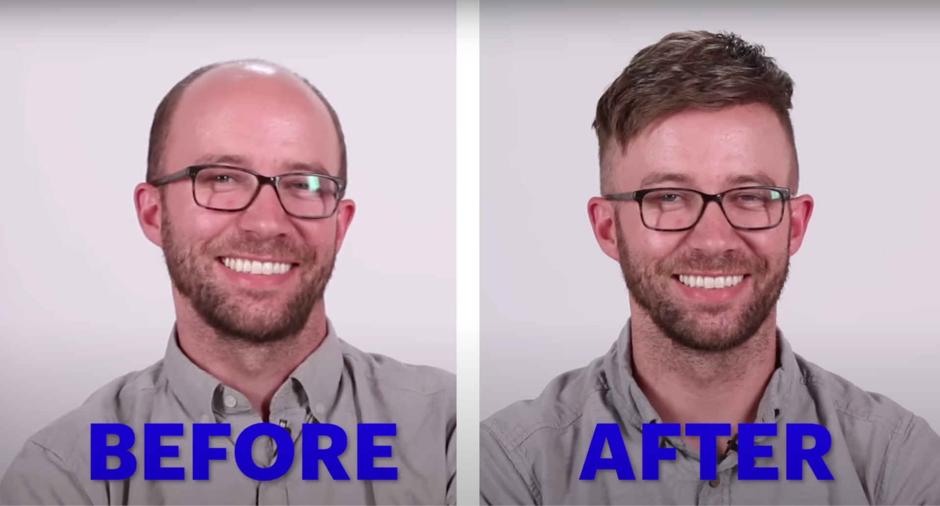 results of using a men's hair system