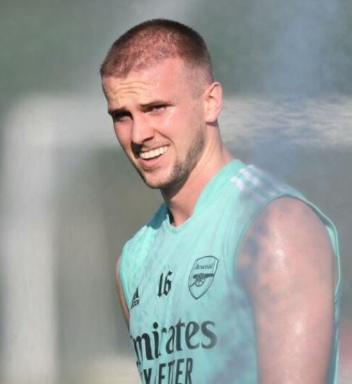 Rob Holding's early hair growth post FUE hair transplant