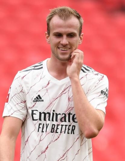 Rob Holding losing hair before hair transplant surgery