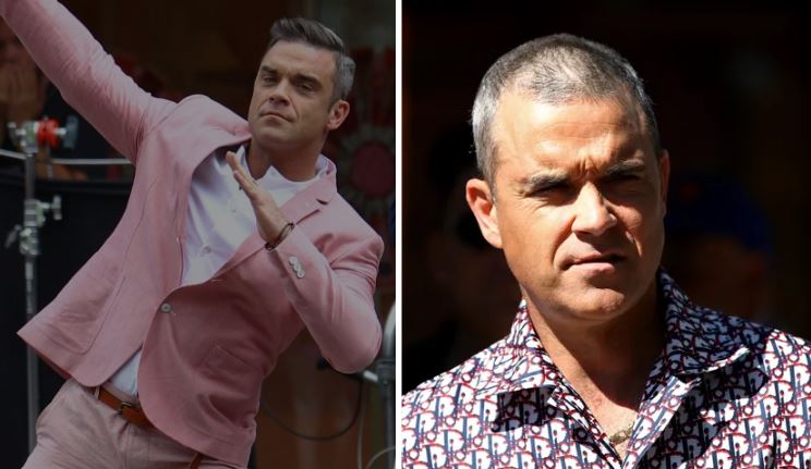 Robbie Williams before and after hair transplant