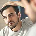 Should You Get A Second Hair Transplant?