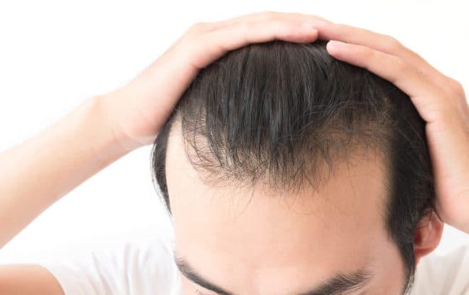 The Wimpole Clinic’s Guide to Combat Thinning Hair.
