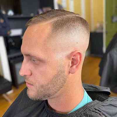 What is the Best Buzz Cut for a Receding Hairline?, Wimpole Clinic