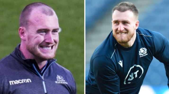 Before and after Stuart Hogg's hair transplant