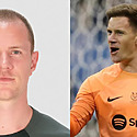 Marc-André Ter Stegen Hair Transplant:  Everything You Need To Know