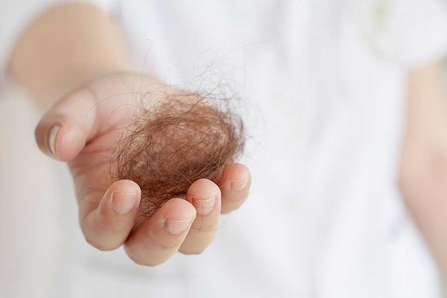 Why Women Don’t Talk About Hair Loss