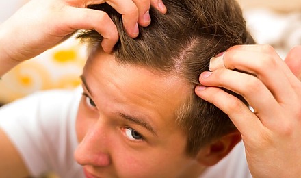 Young Man Checking Hair Loss