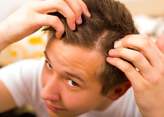 Young Man Checking Hair Loss